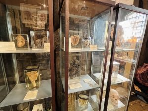 Preserved Organs at The Old Operating Theatre London